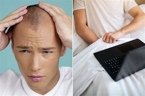 masterbation and baldness|Masturbating too much can cause hair loss in dudes, leading hair .